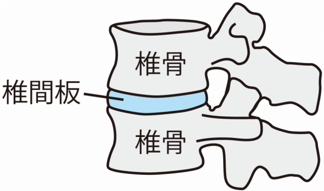 椎間板のイラスト